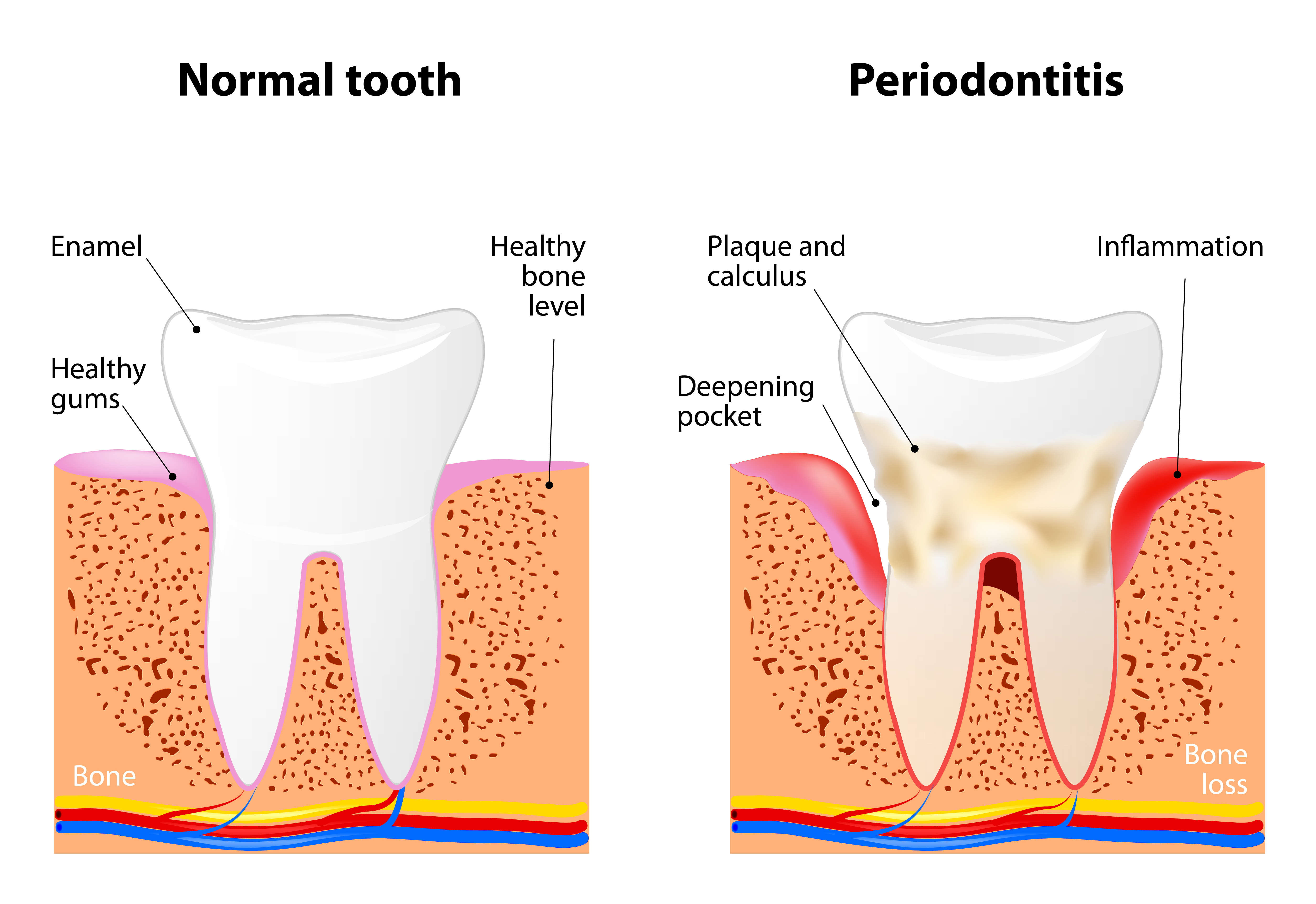 Oral Surgery